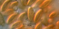 Microscopic image of newly discovered fungus.